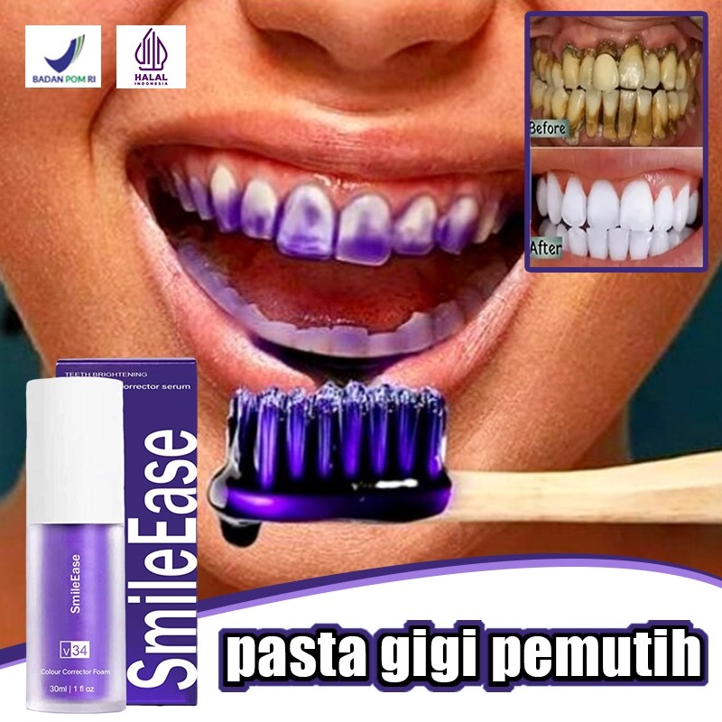 Perontok karang gigi paling ampuh Pasta gigi pemutih Perontok karang gigi 30ml Pembersih karang gigi