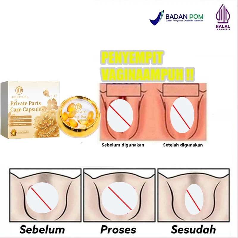 Perapat miss v agar kembali perawan miss v rapet dan wangi jamu rapet miss v kembali perawan 10