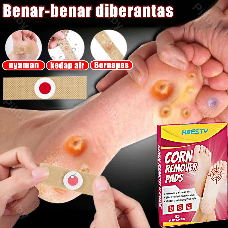 Plester Kutil Mata Ikan Obat Mata Ikan plester mata ikan paling ampuh Obat Kutil dan Mata ikan corn