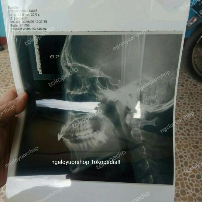 

Paper Yc Film Inkjet Rontgen Paper Film Ronses A4 Terbatas