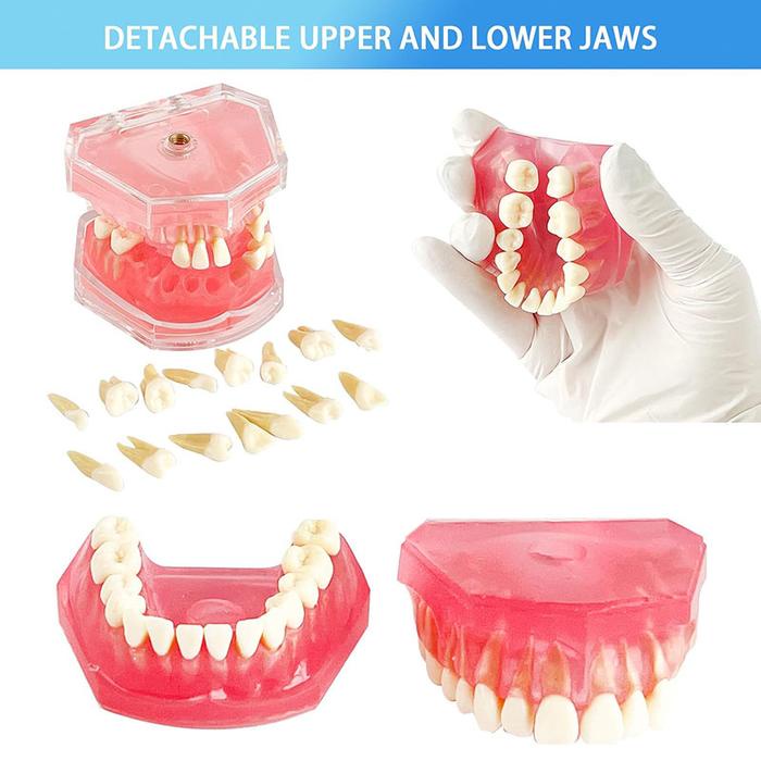 

Model Gigi Edukasi Lepasan Patung Gigi Untuk Belajar Dental Teaching Model Alat Peraga Gigi