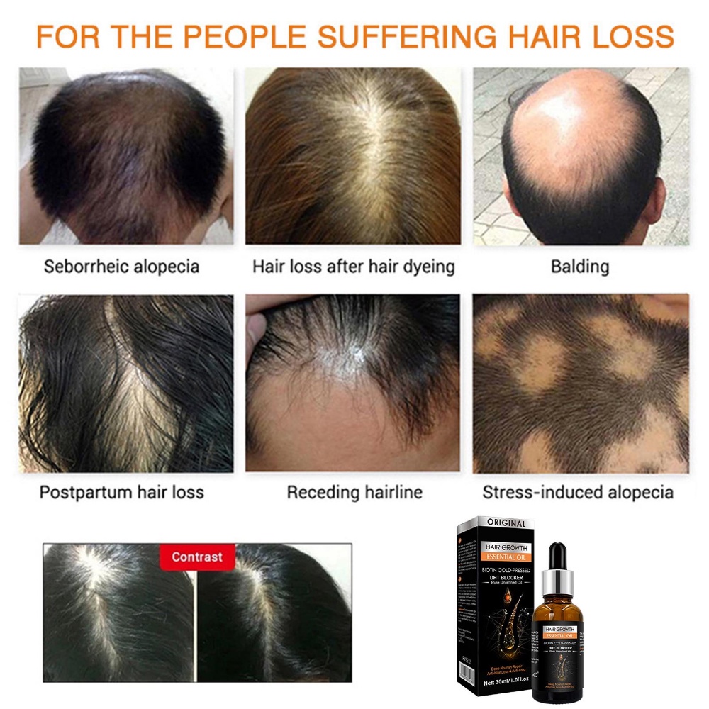 IMPORT HAIR GROWTH ESSENTIAL OIL BIOTIN COLD-PRESSED DHT BLOCKER AND HAIR GROWTH SHAMPOO ANTI-HAIR