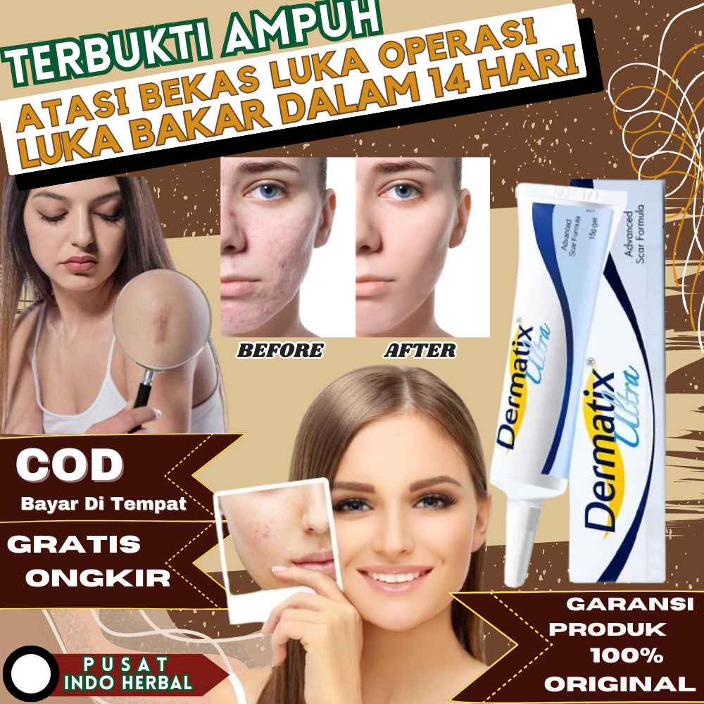 Dermatix Ultra 15gr 100% Original