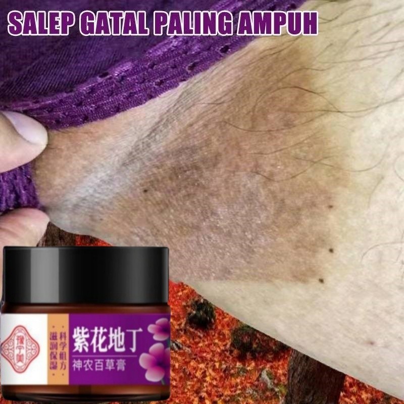 Salep gatal paling ampuh obat gatal selangkangan obat gatal paling ampuh 30g Salep gatal