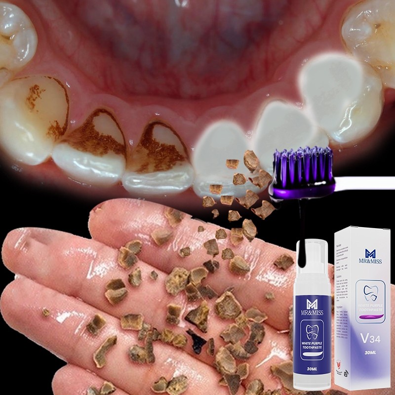 Pasta gigi pemutih pembersih karang gigi odol pemutih gigi dan karang gigi obat bau mulut 30ml
