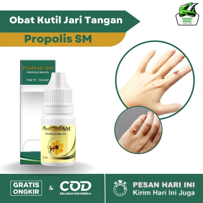 Terlaris- Obat Kutil Di Jari Tangan, Obat Kutil Di Kaki, Obat Kutil Leher