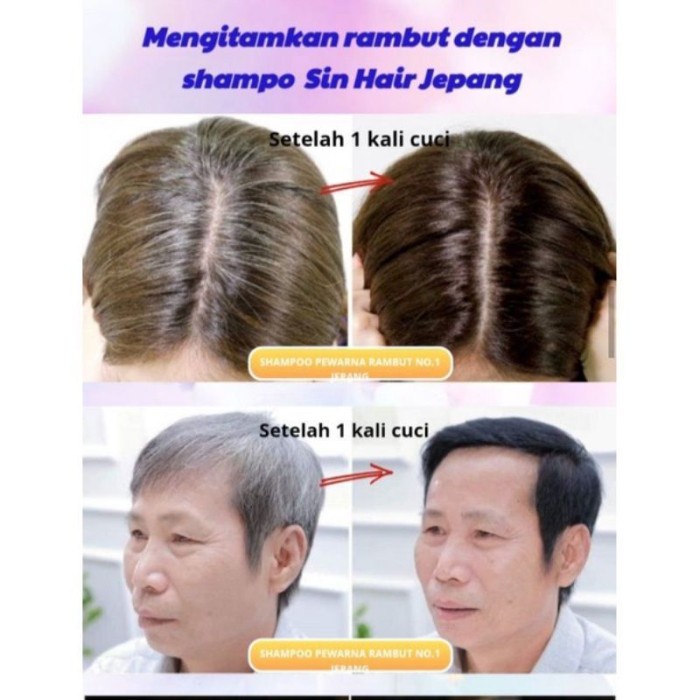 Best Seller Sinhair Shampo .Ready .Shampo Penghitam Uban No 1 Di Jepang.Original