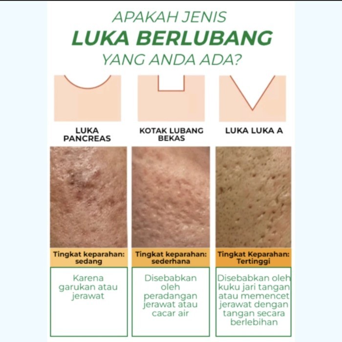 lon VERBLE Serum Bekas Luka Berlubang VERBLE meregenerasi kulit baru