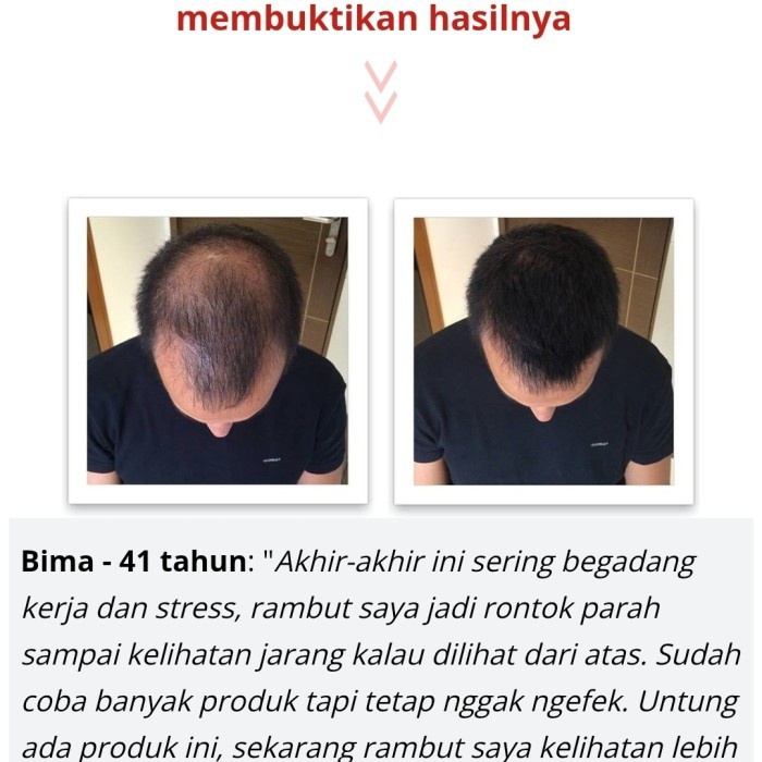 Hair Growth Dht Blocker Serum & Shampoo Penumbuh Rambut Herbal Alami Produk Berkualitas