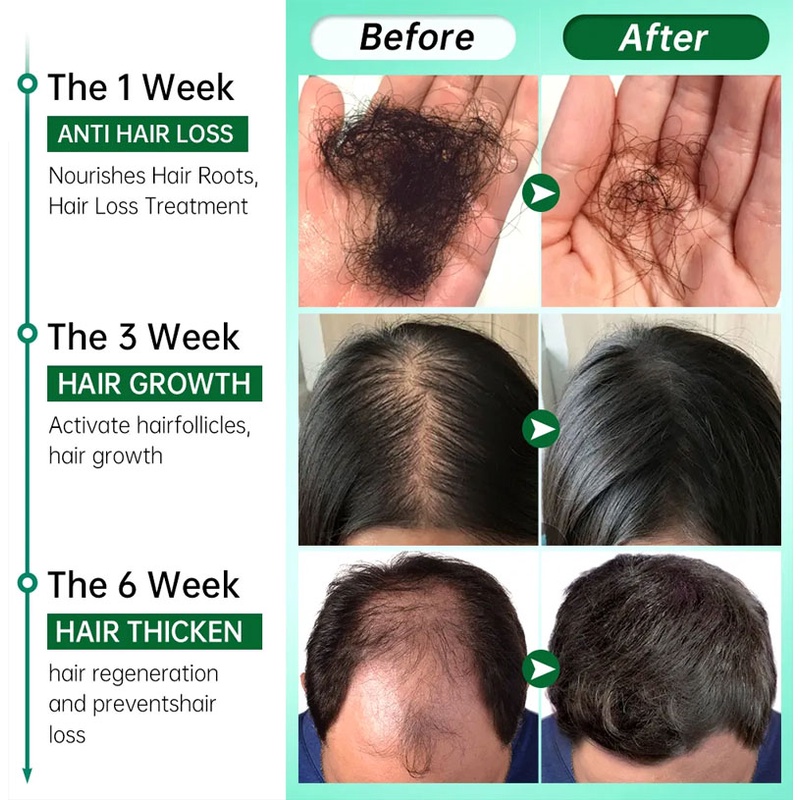 IMPORT 7 DAYS HAIR GROWTH SERUM OIL 20ML DENSE REGROWTH GINGER HAIR CARE REPAIR LIQUID ESSENTIAL
