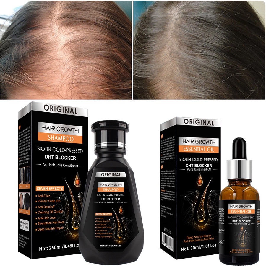 NEW 2PCS/SET HAIR GROWTH ESSENTIAL OIL BIOTIN COLD-PRESSED DHT BLOCKER AND HAIR GROWTH SHAMPOO