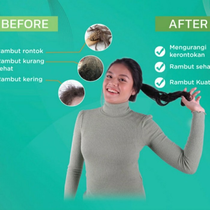 Erha Hairgrow Shampoo 100Ml Erhair Hair Grow 100 Ml Rambut Rontok Produk Unggulan