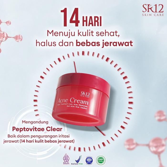 Sr12 Acne Cream Menjaga Elastisitas Kulit Wajah Muka