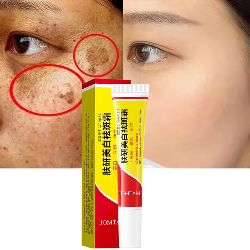 NEW WHITENING FRECKLE CREAM FACE BRIGHTENING CREAM NIACINAMIDE REDUCE CHLOASMA MELASMA MELANIN FADE