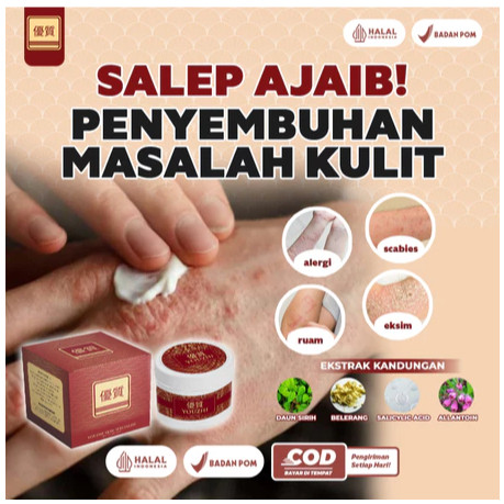 Krim Youzhi Sembuhkan Biduran Kulit Gatal Gatel Isi 10 Gram