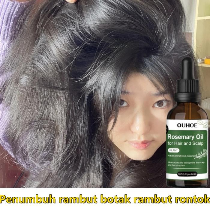 Penumbuh rambut cepat Serum rambut rontok Hair tonic rambut rontok Penumbuh rambut botak Penumbuh