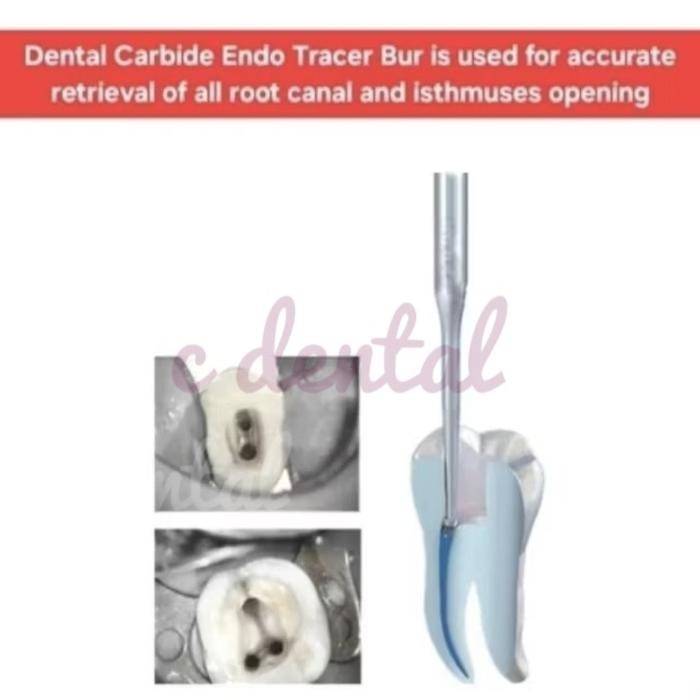 Dental Carbide Endo Tracer Bur Long Slim Shank Opening Access Orifice Isthmus Finder Hidden Canal