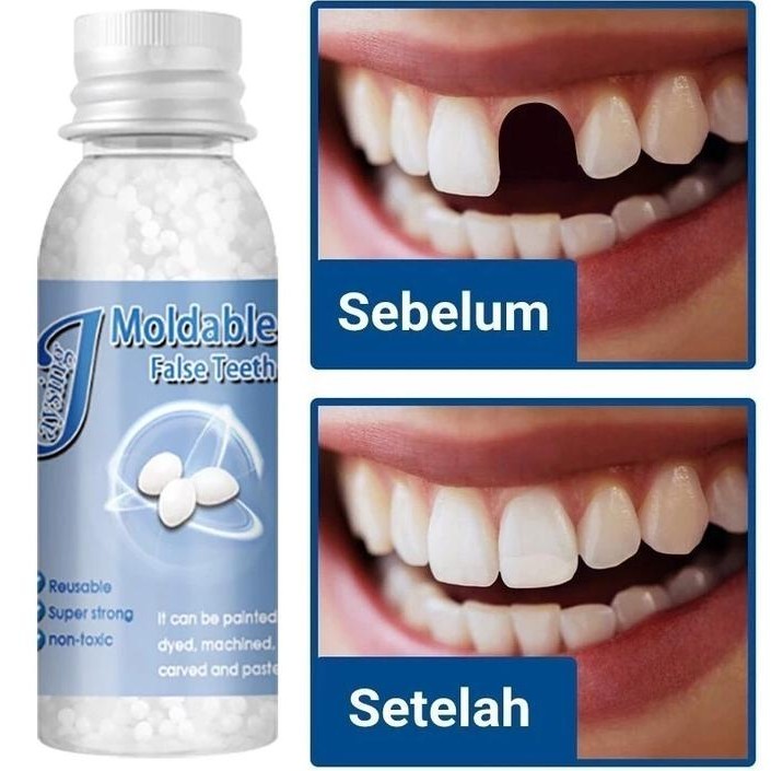 PENAMBAL GIGI BERLUBANG BOLONG GIGI PALSU TEMPEL TAMBALAN GIGI PERMANEN AWET TAHAN LAMA KERAS KUAT