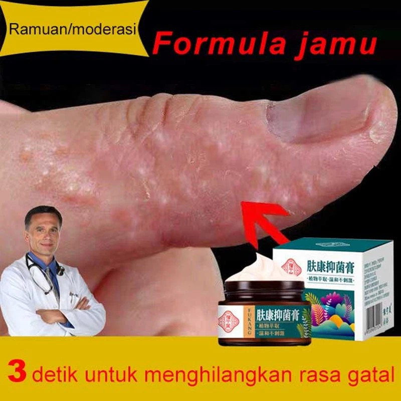 Salep Gatal Paling Ampuh Obat Gatal Paling Ampuh Salep Kulit Gatal Kulit Eksim Gatal Selangkangan
