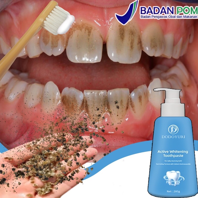 Odol pemutih gigi dan karang gigi Perontok karang gigi paling ampuh Pasta gigi pemutih penghilang