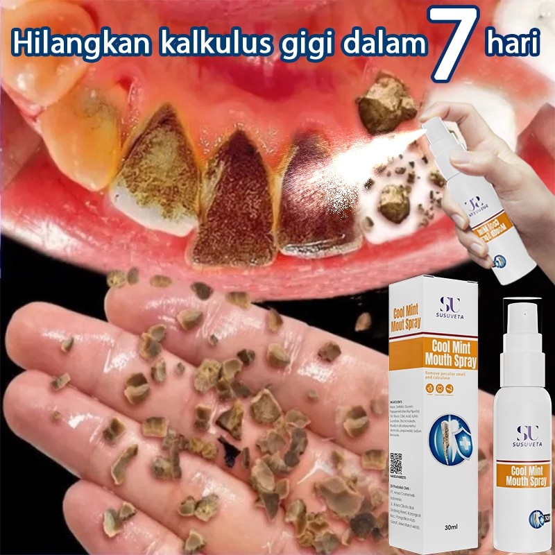 Pembersih gigi kuning dan karang perontok karang gigi paling ampuh pembersih gigi kuning dan karang