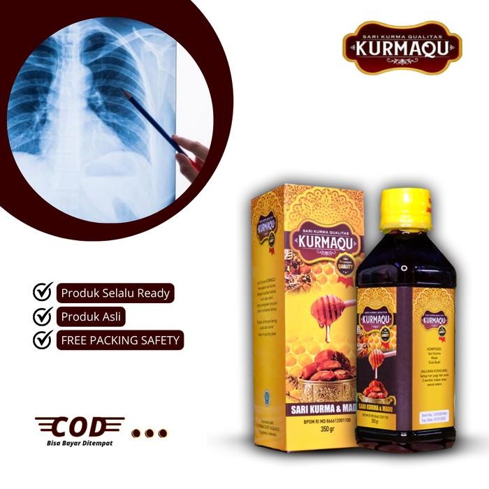

Sari Kurma Pneumonia Paru-Paru Basah Radang Paru-Paru Tbc Pembersih Paru-Paru