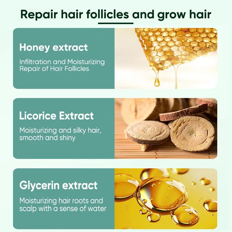 NEW 7 DAYS GINGER HAIR GROWTH SERUM FAST PROMOTE HAIR REGROWTH PRODUCTS ANTI HAIR LOSS REPAIR SCALP