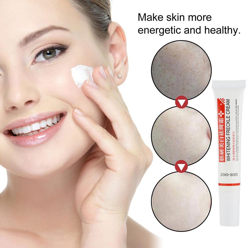 NEW EFFECTIVE WHITENING FRECKLE CREAM REMOVE DARK SPOTS ANTI FRECKLE CREAM NIACINAMIDE FADE