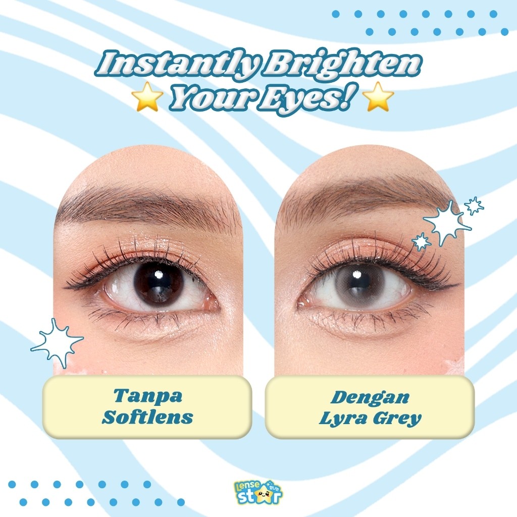 Softlens Minus Lense Star Lyra y Normal, -0.50 s/d -10.00