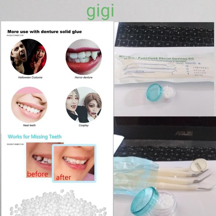 GIGI PALSU SEMENTARA PENAMBAL GIGI RENGGANG PATAH SET ALAT GIGI