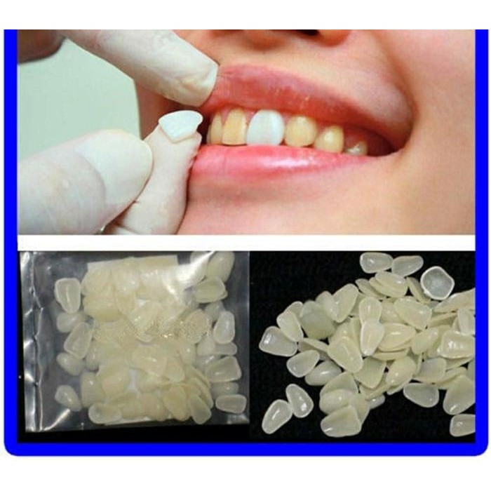 Veneer Gigi Palsu Putih 70 pcs Pemutih Gigi Estetika Gigi Bersih