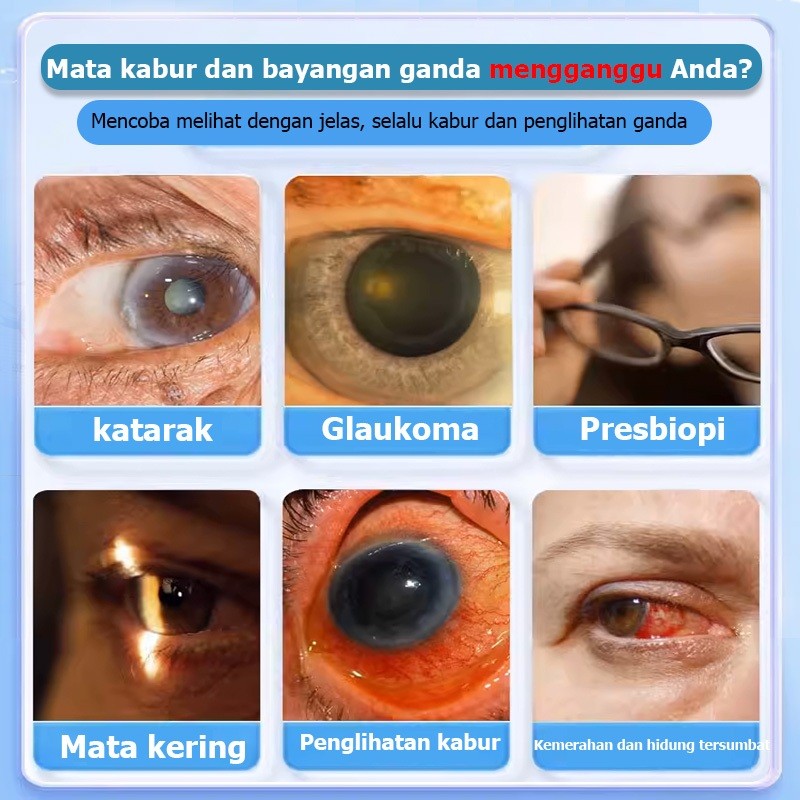 Obat mata katarak Obat mata minus Obat tetes mata Tetes mata 15ml Obat mata Obat katarak Obat tetes