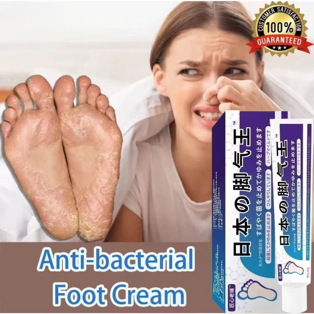 MD Obat Kaki Rayapan 20g salep gatel2 paling ampuh Obat Telapak Kaki Rayapan salep gatal kulit ampuh