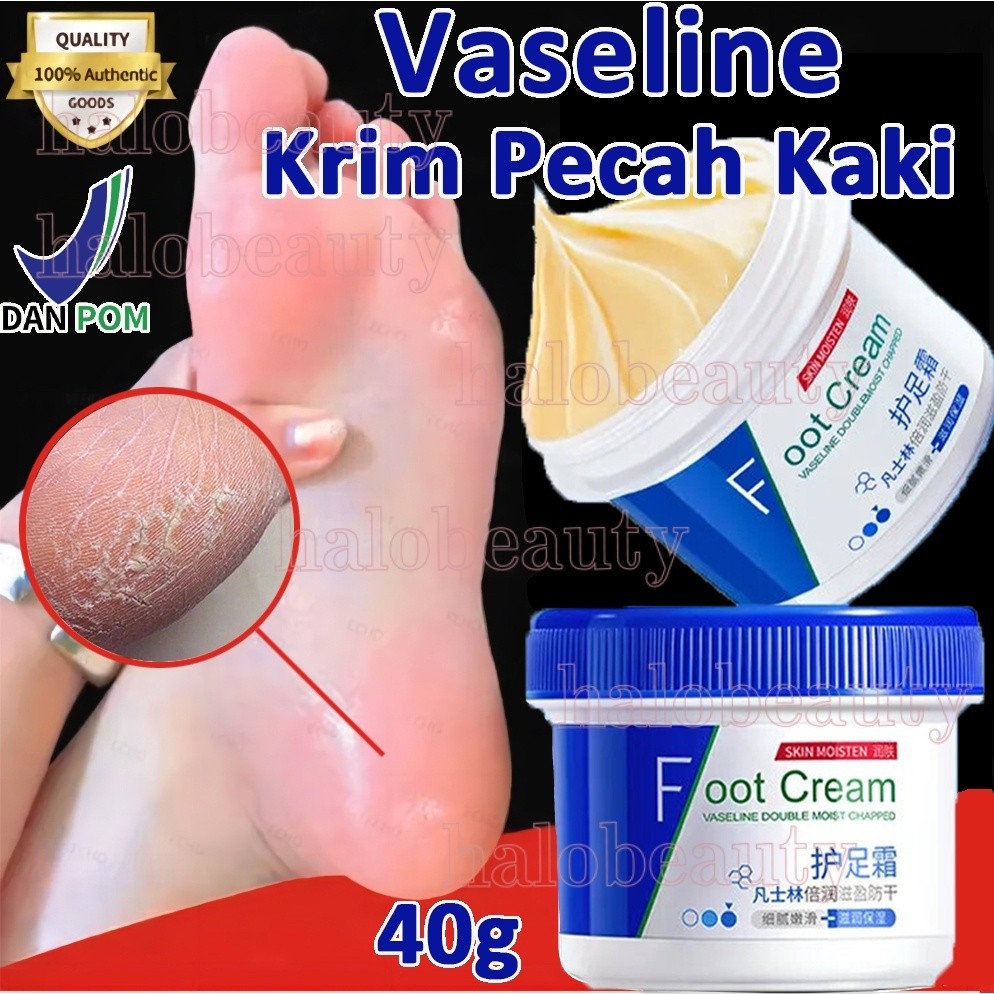 MD Vaseline Kaki Pecah Dan Kering Foot Cream Obat Kaki Pecah Pelembab Kaki Kering Dan Pecah