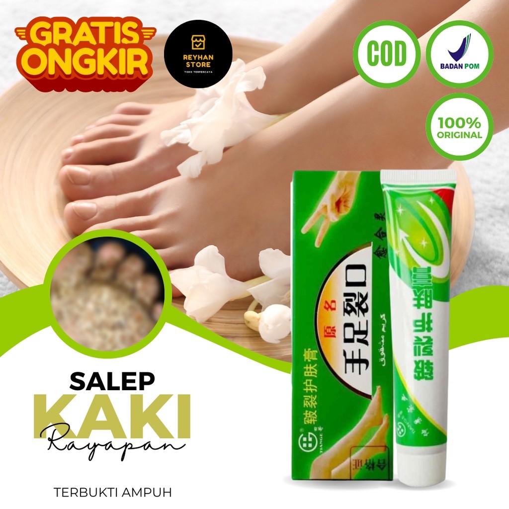 MD Obat Kaki Rayapan Dan Bau Salep Cina Obat Gatal Krim Pengelupas Kulit Mati Kaki Pembersih Kulit