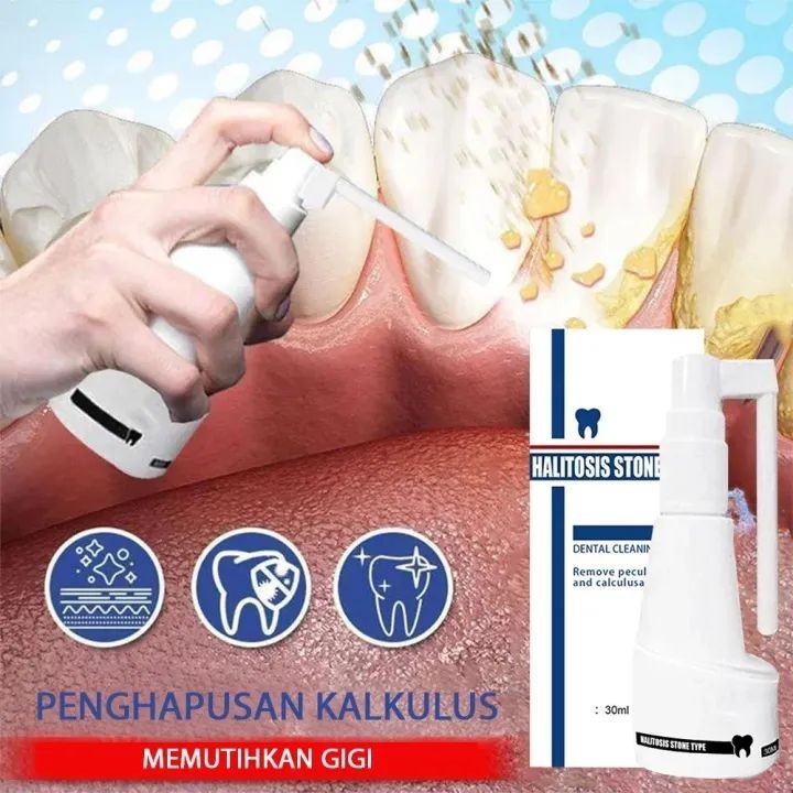 Jaysuing Pembersih karang gigi Penghilang karang gigi membandel alat pembersih karang gigi 30ml