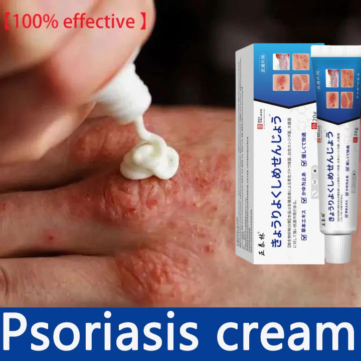 Salep Alergi Kulit Gatal Eksim Salep Gatal Kulit Ampuh Cina gatal selangkangan 20g Cocok untuk desa