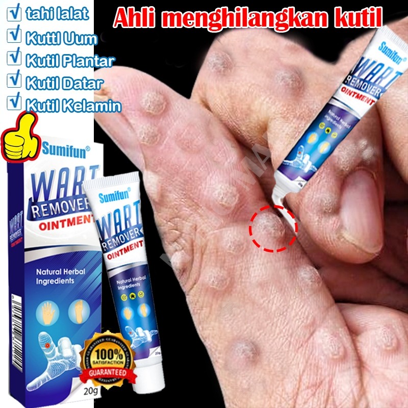 Penghilang kutil Salep kutil Penghilang Kutil Leher Obat kutil paling ampuh wart removal cream skin