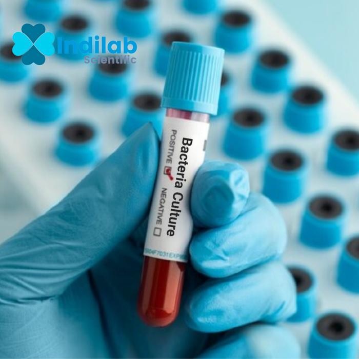 Kultur Bakteri Lactobacillus plantarum