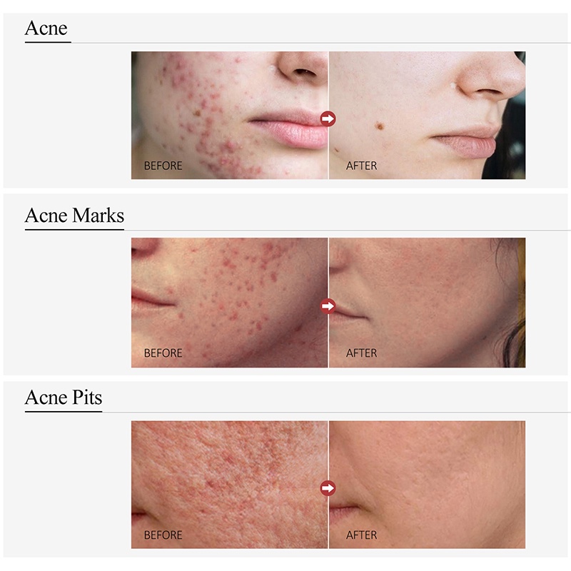 IMPORT AUQUEST COLLAGEN FACE SERUM WHITENING DARK SPOTS REMOVAL PORE SHRINKING HYALURONIC ACID