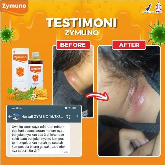 

Terlaris- Zymuno Original Herbal Terapi Kanker Tumor Cegah Flu Demam Batuk -Gratisongkir