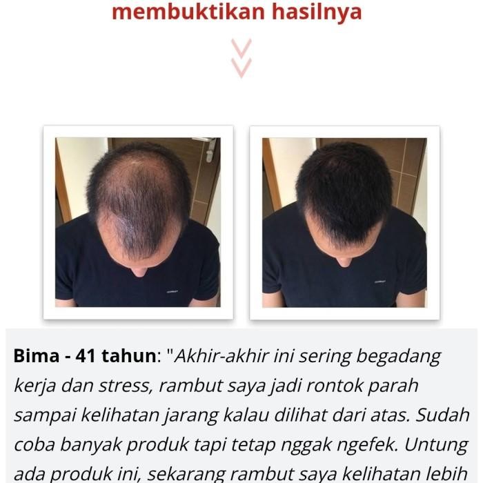 Promo Hair Growth Dht Blocker Serum & Shampoo Penumbuh Rambut Herbal Alami Ready