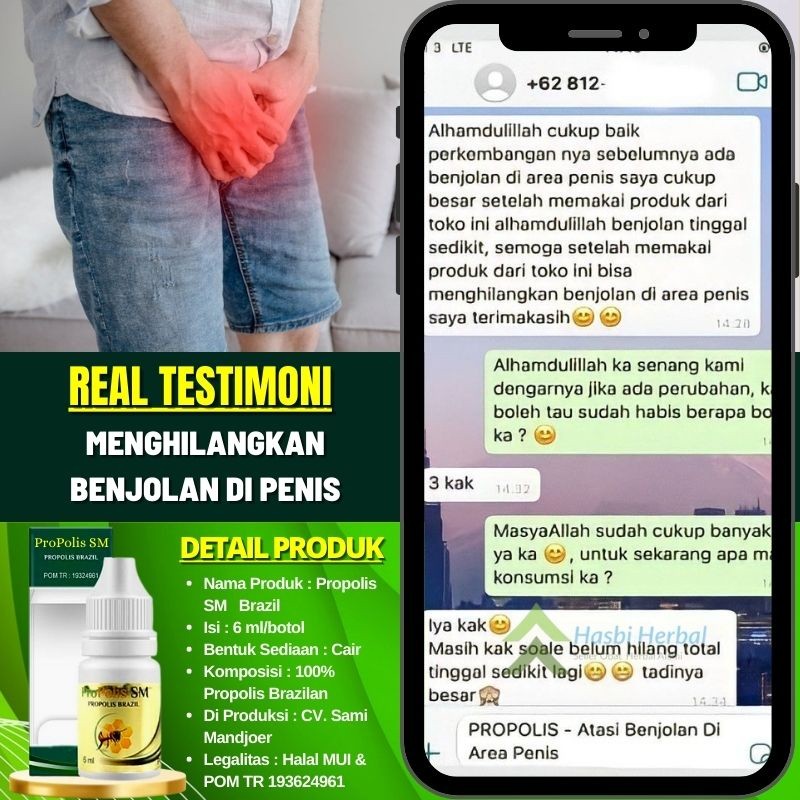 Obat Oles Penis Gatal - Gatal, Obat Buah Zakar Gatal, Penghilang Benjolan di Penis, Obat Merah Gatal