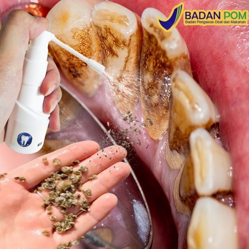 Pembersih karang gigi Alat pembersih karang gigi Penghilang karang gigi 30ml Pemutih Gigi Kuning