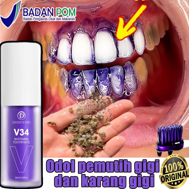 Odol pemutih gigi dan karang gigi Perontok karang gigi paling ampuh Pasta gigi pemutih penghilang