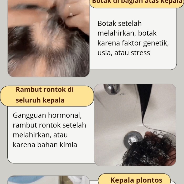 Hair Growth Dht Blocker Serum & Shampoo Penumbuh Rambut Herbal Alami High Quality