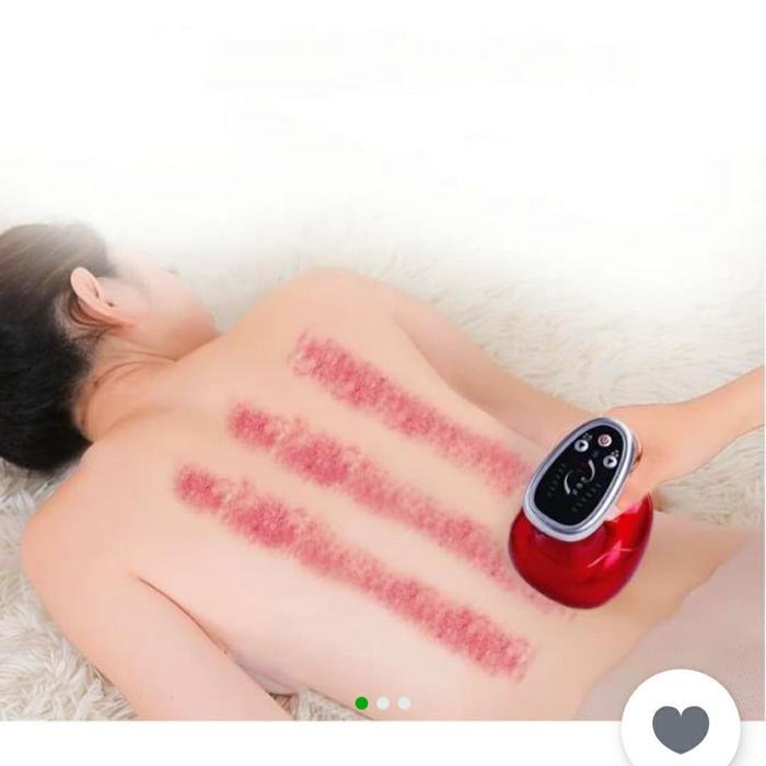 PALING MURAH. ALAT KEROKAN ELECTRIK/ TERAPI BEKAM KOP ANGIN KEROK ELECTRIK