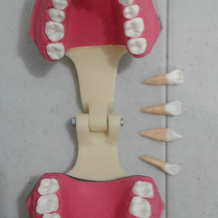 Model Gigi Lepas Pasang