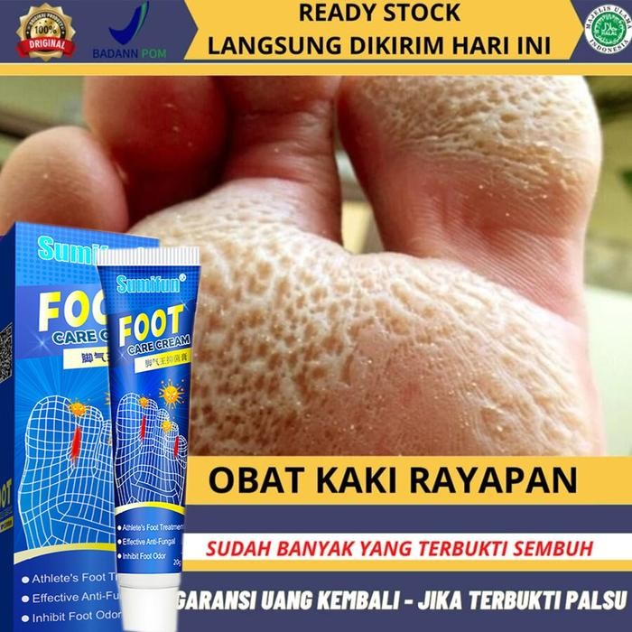 NetPac obat kaki rayapan dan bau Obat Kaki Rayapan penghilang bau kaki Obat Kaki Rayapan Paling