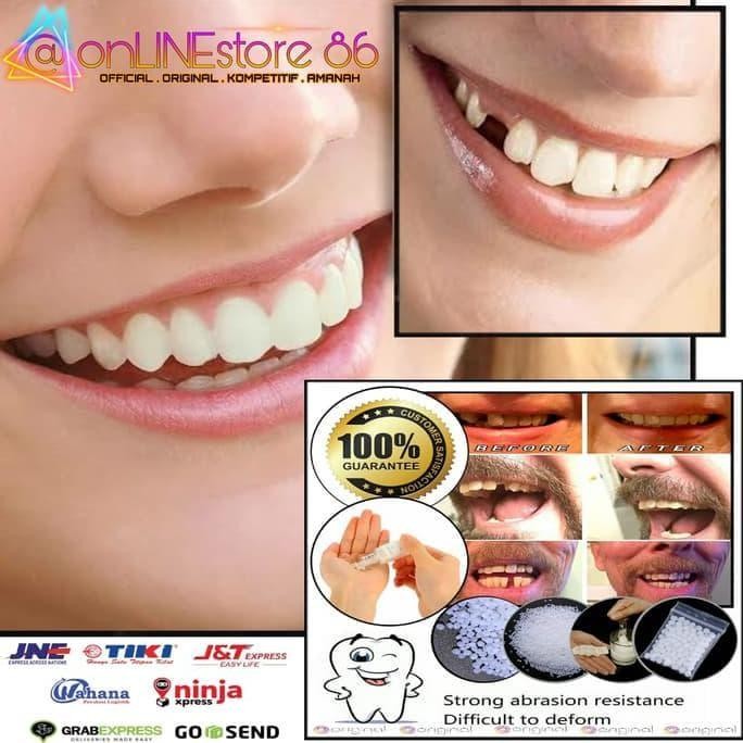 Gigi Palsu Temptooth Temporary tooth Lem Tambal Gigi Instan Kuat A